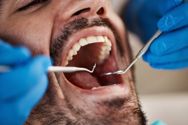 Best Holiday Emergency Dentist in Okawvle, IL